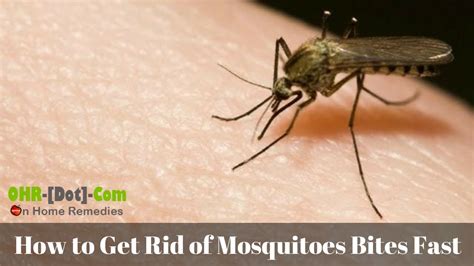 How To Get Rid Of Mosquito Bites Overnight 8 Home Remedies Youtube