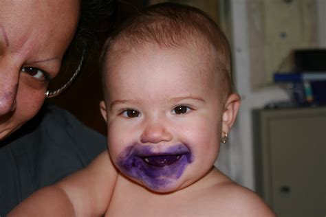 Gentian Violet For Thrush Newborn Pictures To Pin On