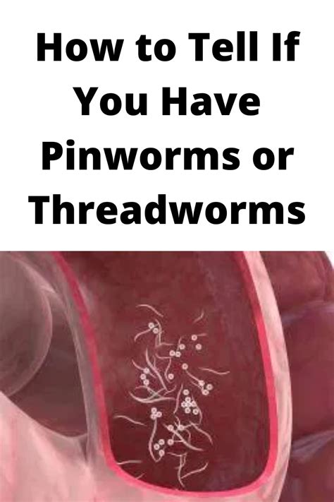 How To Tell If You Have Pinworms Or Threadworms How To Treat Pinworms Pinworm Treatment Pin