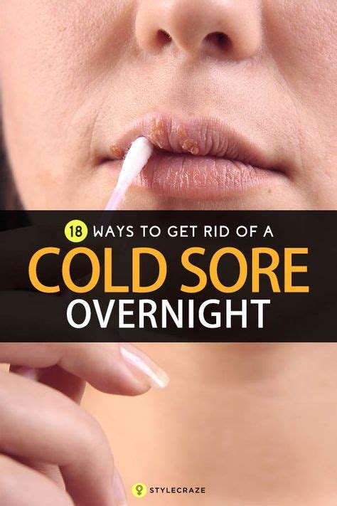 How To Get Rid Of Cold Sores 19 Ways Healing Cold Sore Get Rid Of
