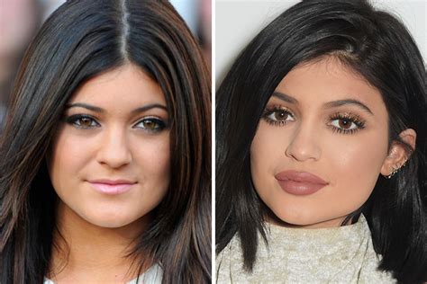 Hollywood Stars Before And After Plastic Surgery - Viral ...