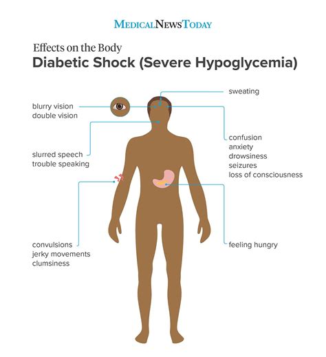 Type 1 Diabetes Log Sheet - DiabetesWalls