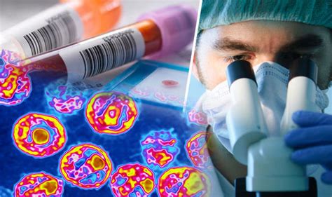Hiv Breakthrough British Scientists On The Brink Of Extraordinary