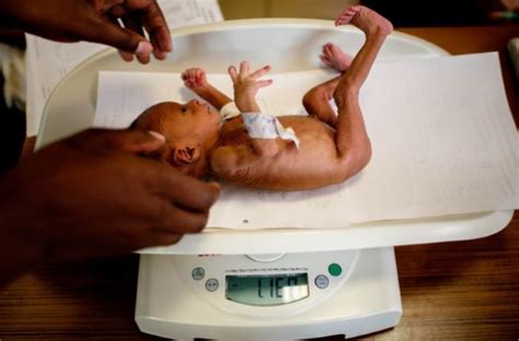 There are many causes for low birth weight babies. Newborn Baby Weights - newborn baby