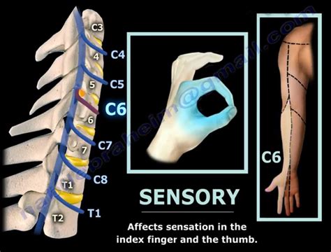 Neck Pain Cervical Disc Herniation And Radiculopathy Images And