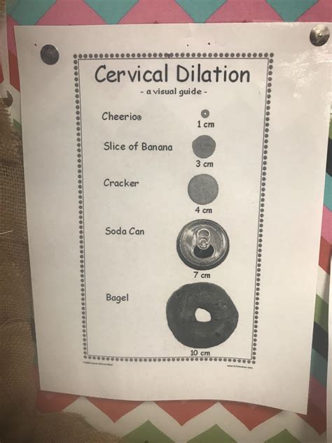 Chart Illustrating Dilation Of Cervix During Labor Mildlyinteresting