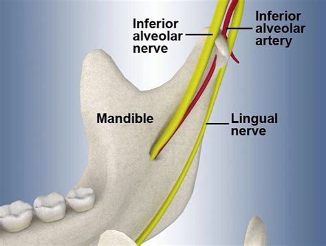 Dentalchat on Instagram: “ðð¬ The inferior alveolar block is a common
