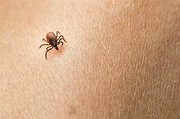 These horrifying pictures show the exact tick bite symptoms to look for ...