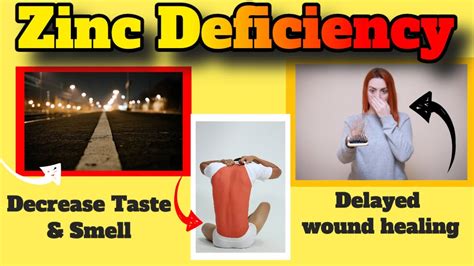 The Zinc Deficiency Symptoms You Probably Dont Know About Youtube