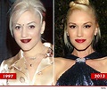 Gwen Stefani Plastic Surgery: The Transformation That Made Look Great