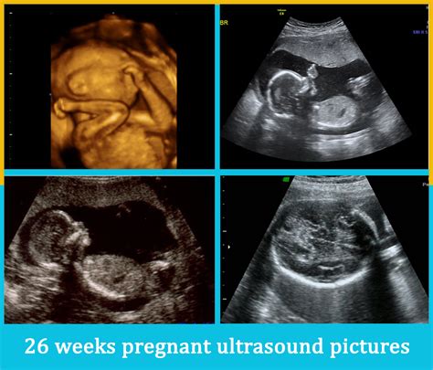 26 Weeks Pregnant Ultrasound Pictures Pregnantsh
