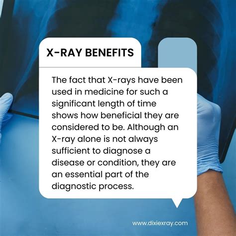 Dixie X Ray Some Of The Main Benefits Of X Rays Are As