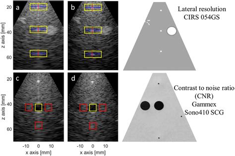 Lateral Resolution