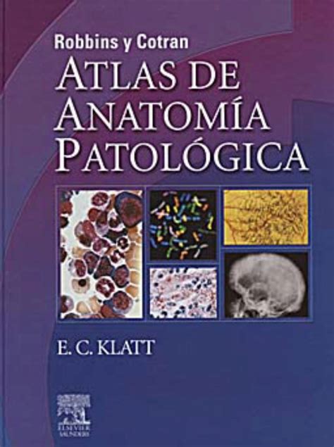 Robbins Y Cotran Atlas De Anatomía Patológica