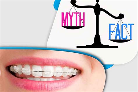 Dent Busters Myths About Braces Elite Clinic