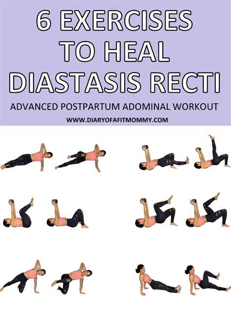 35 6 Exercises To Fix And Heal Diastasis Recti Advanced Postpartum