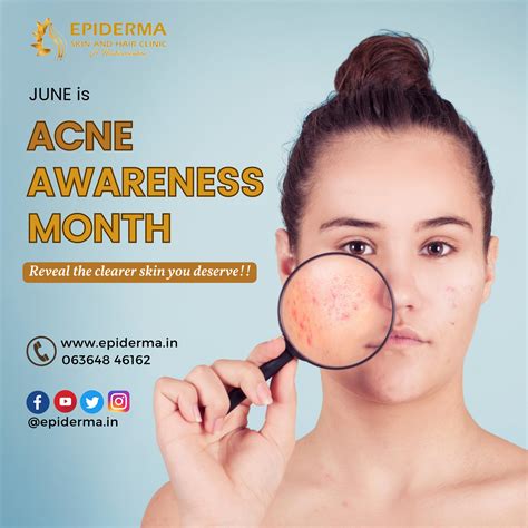 June Is Acne Awareness Month Epiderma Skin And Hair Clinic Jayanagar