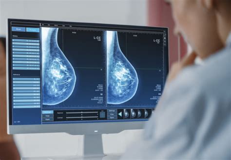 Ai Breast Cancer Screening Project Wins Government Funding For Nhs