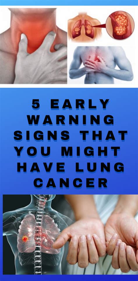 5 Early Warning Signs That You Might Have Lung Cancer Wellness Days