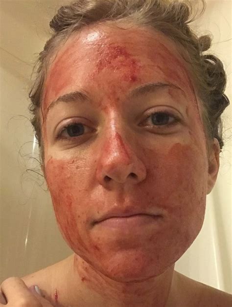 Complete Insanity Leftist Smears Menstrual Blood All Over Her Face To