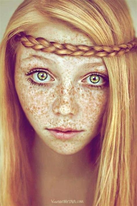 Everything Is Outrageously Gorgeous On This Girl Beautiful Freckles