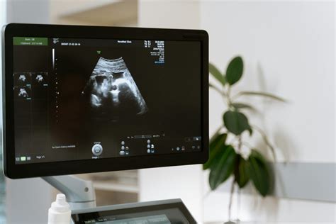 Photo Of Ultrasound Testing · Free Stock Photo