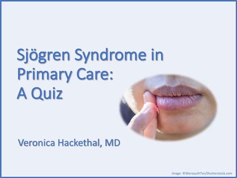 Sjögren Syndrome In Primary Care A Quiz Rheumatology Network