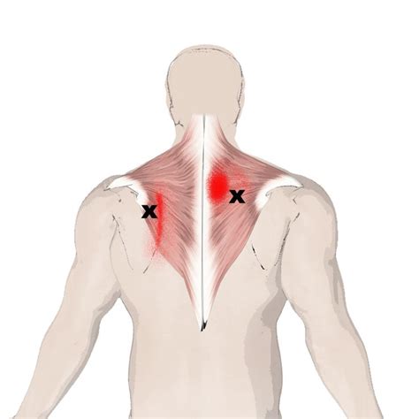 The Trapezius Muscle This Months Muscle Of The Month Muscle