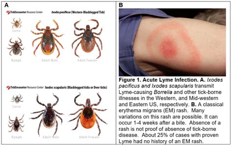 Lyme Disease Research Naviaux Lab