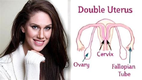 uterus didelphys meet the woman with the double uterus youtube