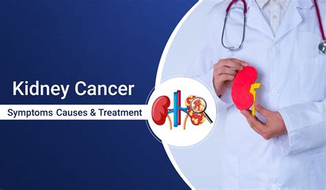 Kidney Cancer Symptoms Causes And Treatment