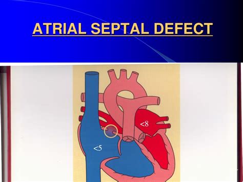 Ppt Pediatric Board Review 2013 Pediatric Cardiology Powerpoint