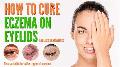 How To Cure Eczema On Eyelids Eyelids Dermatitis Treatment And