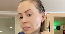 Alyssa Milano demonstrates major hair loss in honest video after ...