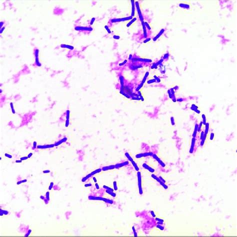 Gram Stain Of The Positive Anaerobic Blood Culture Bottle Showing