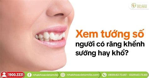 Xem Tướng Số Người Có Răng Khểnh Sướng Hay Khổ