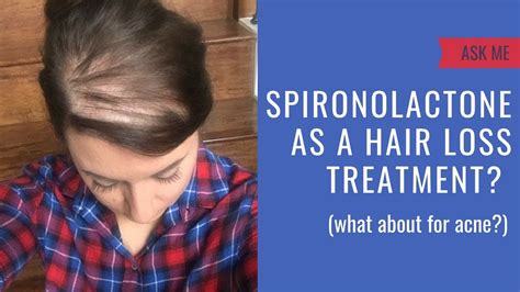 Top Image Does Spironolactone Cause Hair Loss Thptnganamst Edu Vn