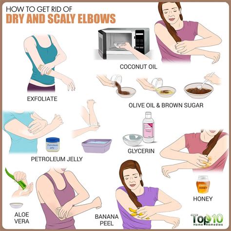 How To Treat Dry And Scaly Elbows With Home Remedies Top
