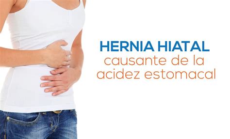 Hernia De Hiato Síntomas ⊛ ¡prevención Y Tratamiento 2020