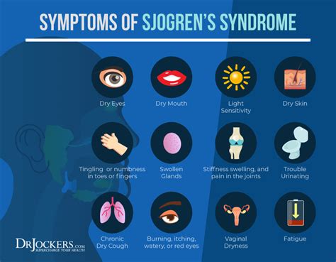 Sjogren S Syndrome Info Artofit