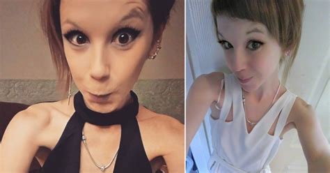 Woman Died Weighing Less Than 4 Stone Due To Lack Of Anorexia Services