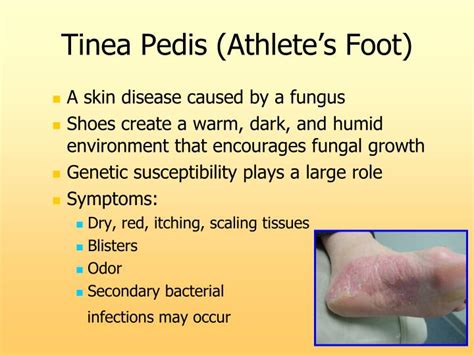 Ppt Common Skin And Nail Conditions In Podiatric Medicine Powerpoint