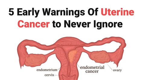 5 Early Warnings Of Uterine Cancer To Never Ignore