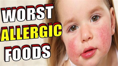Check spelling or type a new query. The 8 Worst Foods That Cause The Most Allergic Reactions ...