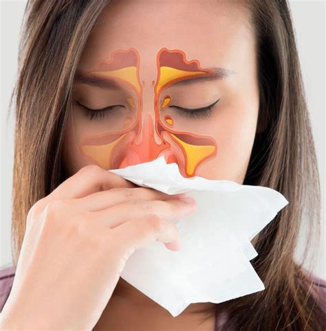 Enfermedades Y Causas Del Sangrado Nasal