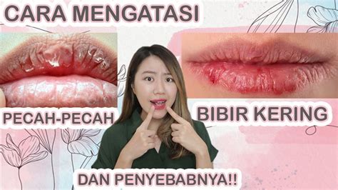 Penyebab Bibir Kering Pecah Pecah Bahkan Berdarah Cara Mengatasinya Youtube