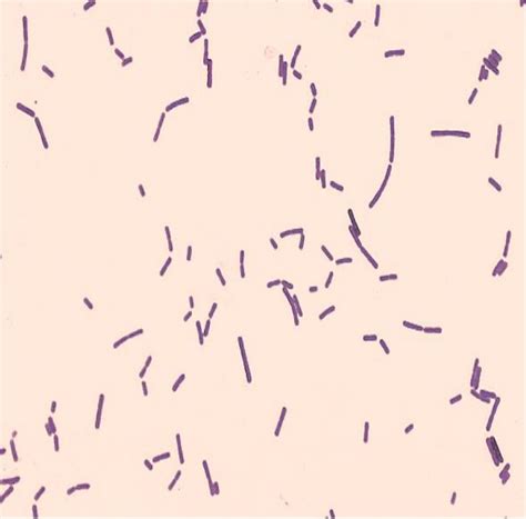 Gram Stain Red Mountain Microbiology