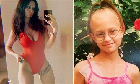 Inspirational Model Tessa Snyder Who Had Leg Amputated At 11 Encourages Others To Be Proud Of