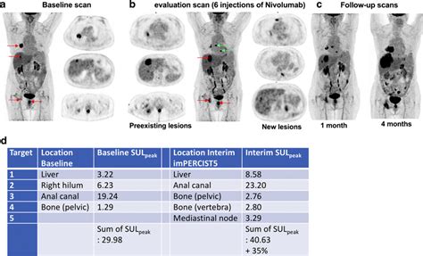 Illustration Of Target Selection And ¹⁸f Fdg Petct Response