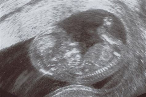 Embryo Entwicklung Bis Zum Fötus Das Passiert In Deinem Baby Bauch